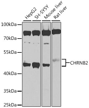 Western blot analysis of extracts of various cell lines using CHRNB2 Polyclonal Antibody at 1:1000 dilution.