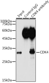 Immunoprecipitation analysis of 300ug extracts of HeLa cells using 3ug CDK4 Polyclonal Antibody. Western blot was performed from the immunoprecipitate usin