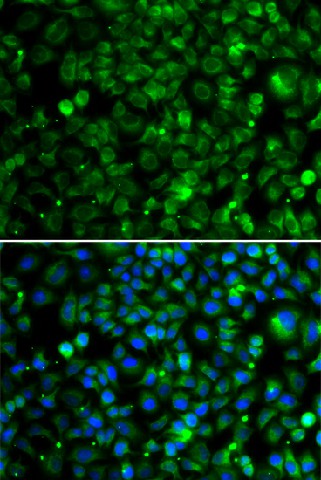 Immunofluorescence analysis of MCF-7 cells using TMLHE Polyclonal Antibody