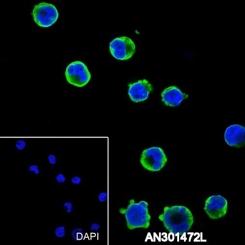 Recombinant CD25 Monoclonal Antibody - 2