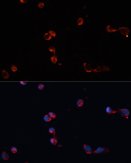 Immunofluorescence analysis of HeLa cells using CAT Polyclonal Antibody at dilution of  1:100. Blue: DAPI for nuclear staining.