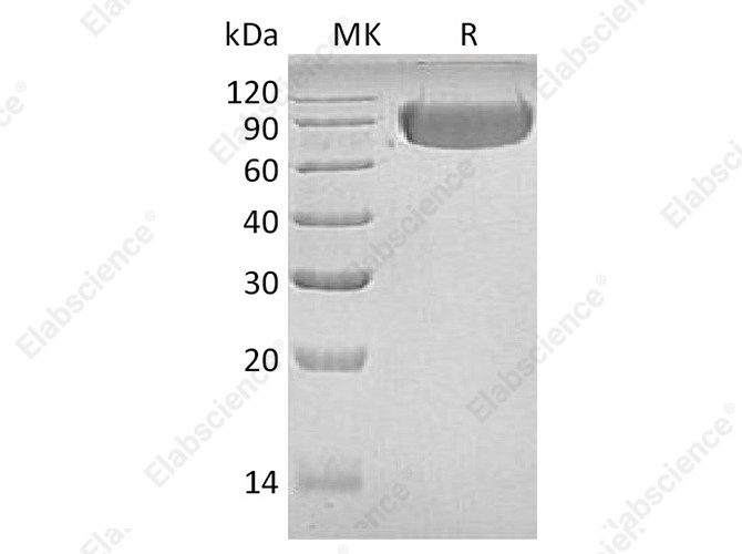 Recombinant Human LAG3/CD223 Protein (Fc Tag) - 1