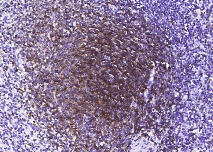 Recombinant CD79A/Ig-alpha Monoclonal Antibody - small - 2