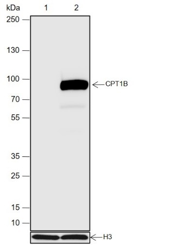 Recombinant CPT1B Monoclonal Antibody-searchlist-1