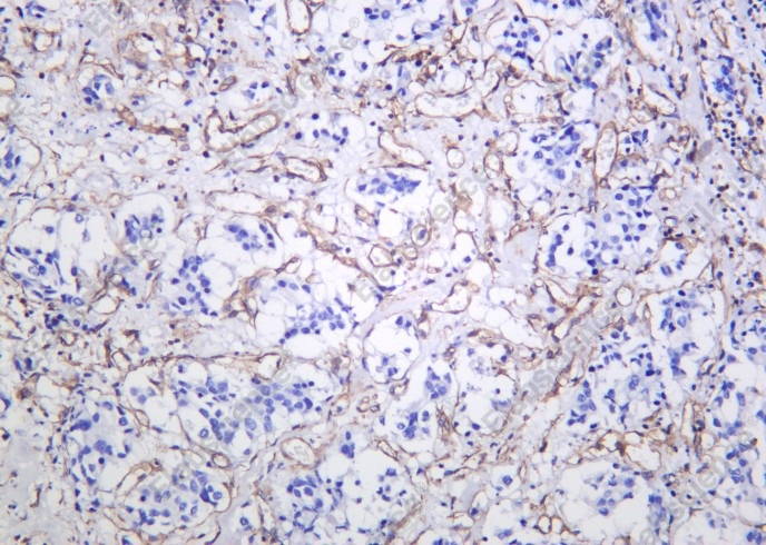 Recombinant CHOP Monoclonal Antibody - 2