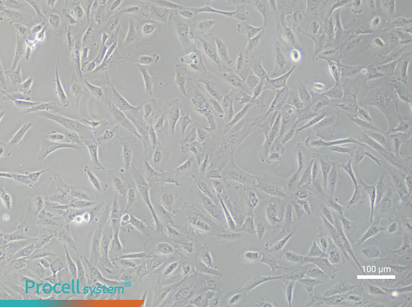 Human Keloid Fibroblast (Primary cell immortalization) Complete MediumHuman Keloid Fibroblast (Primary cell immortalization) Complete Medium - 1