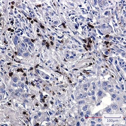 Recombinant FE65 Monoclonal Antibody - 2