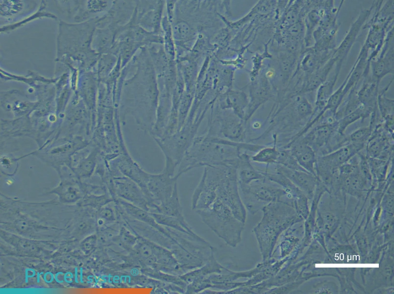 Mouse Cerebral Artery Smooth Muscle Cell Complete Medium - 5