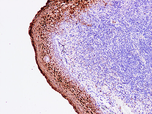 Immunohistochemistry of paraffinembedded Human tonsil tissue with Annexin A1 Monoclonal Antibody(Antigen repaired by EDTA).