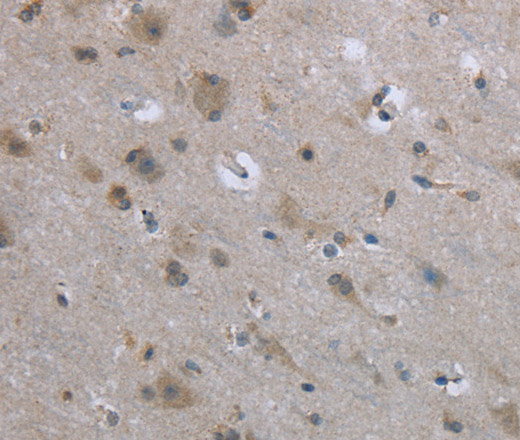 Immunohistochemistry of paraffin-embedded Human brain tissue using EGFL8 Polyclonal Antibody at dilution 1:40