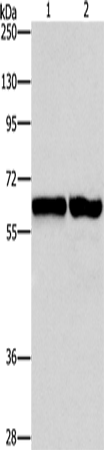 Western Blot analysis of 231 and NIH/3T3 cell using ASNS Polyclonal Antibody at dilution of 1:800