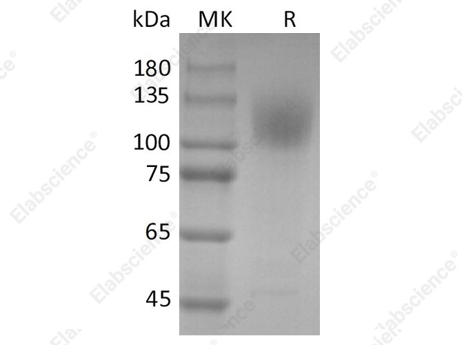 Recombinant SARS-CoV-2 S1 Protein (His Tag) - 1