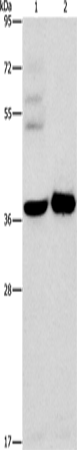 Western Blot analysis of A172 cell and Human fetal brain tissue using SERPINE2 Polyclonal Antibody at dilution of 1:450