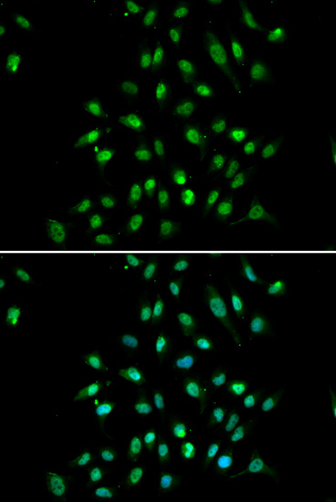 Immunofluorescence analysis of A549 cells using CXXC1 Polyclonal Antibody Blue: DAPI for nuclear staining.