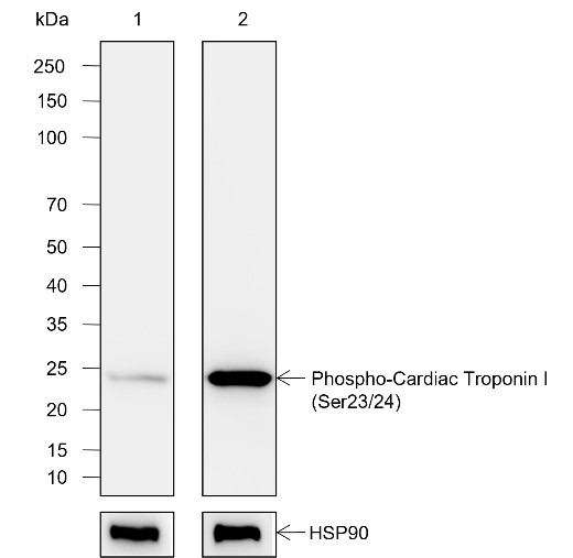 Recombinant Phospho-Cardiac Troponin I (Ser23, Ser24) Monoclonal Antibody-searchlist-1