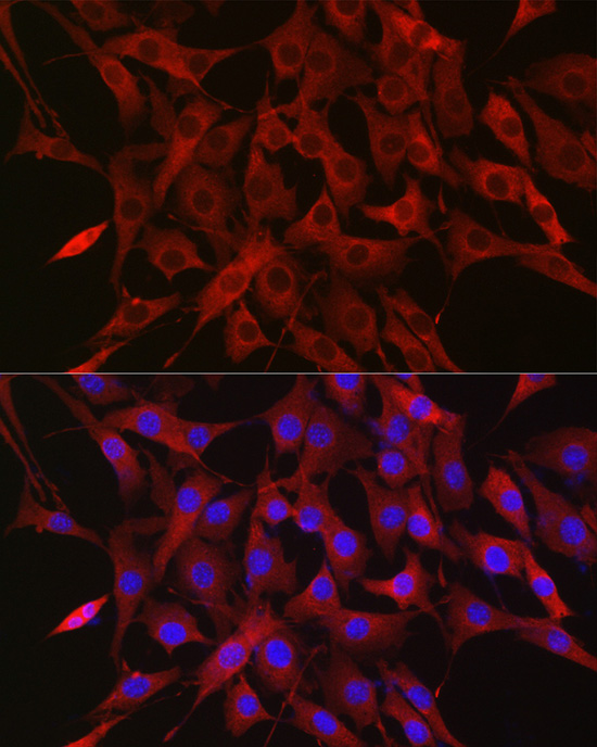 Immunofluorescence analysis of NIH/3T3 cells using Ubiquitin Polyclonal Antibody at dilution of 1:50 (40x lens). Blue: DAPI for nuclear staining.