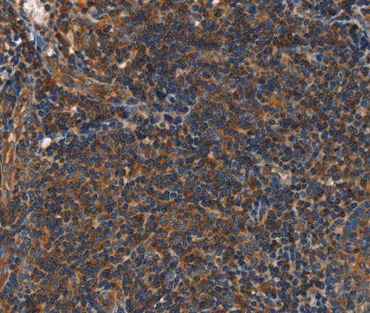 Immunohistochemistry of paraffin-embedded Human tonsil using PLIN2 Polyclonal Antibody at dilution of 1:40