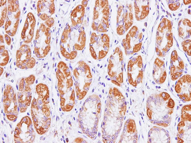 Immunohistochemistry of paraffin-embedded Human stomach using Cytochrome c1 Polyclonal Antibody at dilution of 1:100(400?)