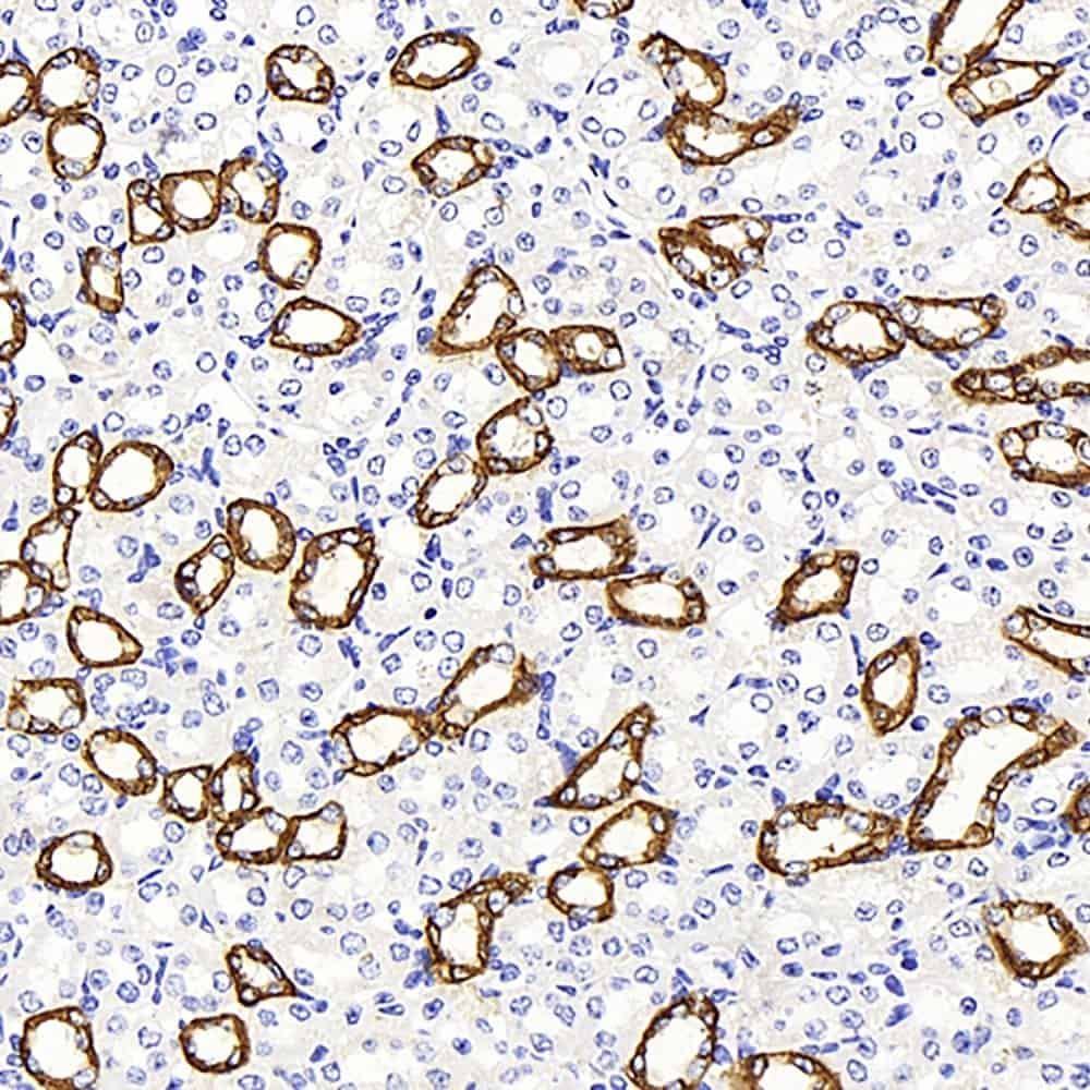 Immunohistochemistry analysis of paraffin-embedded mouse kidney  using AQP3 Polyclonal Antibody at dilution of 1:300.