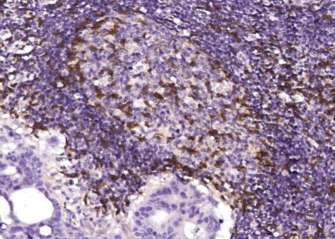 CD2 Monoclonal Antibody - small - 2