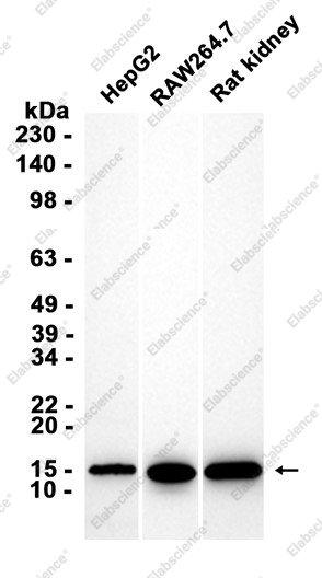Recombinant UBE2D3 Monoclonal Antibody - 2