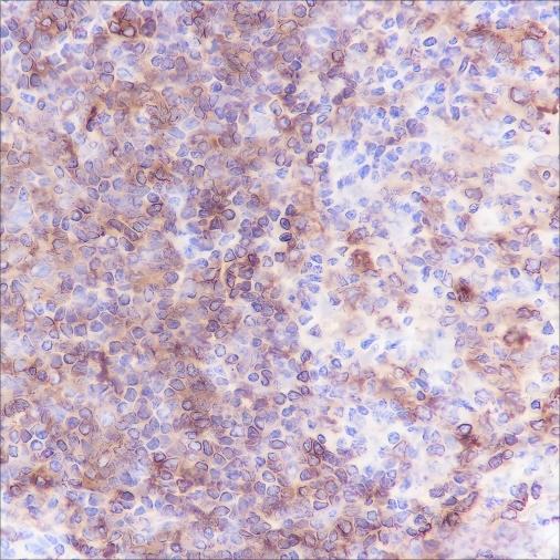 Recombinant HLA-DPB1 Monoclonal Antibody - small - 2