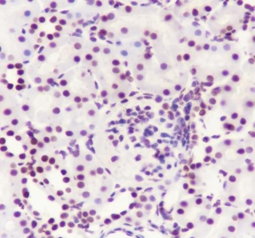 Recombinant SMARCA2/BRM Monoclonal Antibody - small - 5