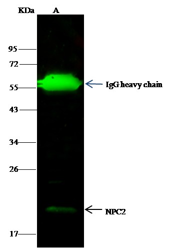Recombinant NPC2 Monoclonal Antibody - small - 1