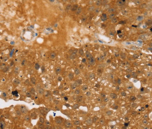 TBC1D4 Polyclonal Antibody - 2