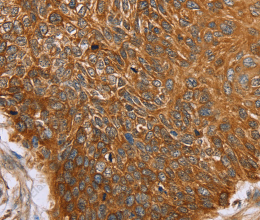 PAICS Polyclonal Antibody - 3