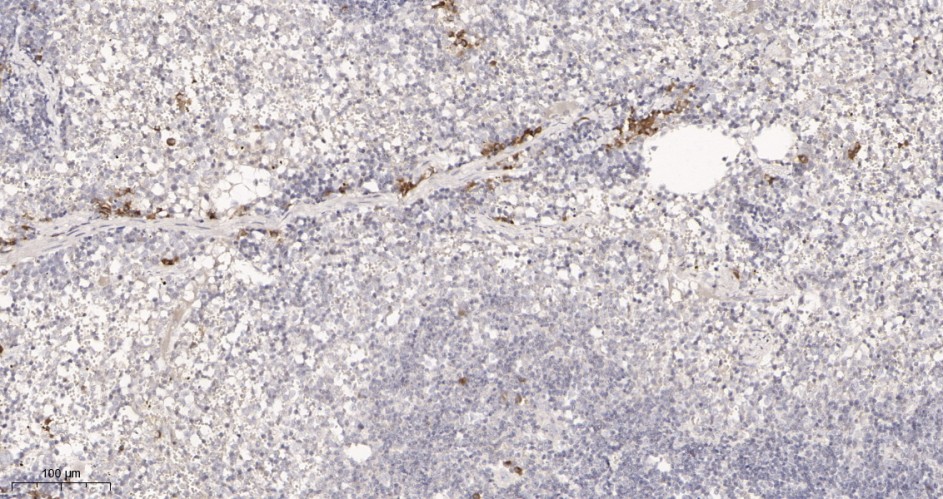Recombinant IL18 Monoclonal Antibody - small - 3