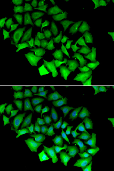 Immunofluorescence analysis of HeLa cells using ACY1 Polyclonal Antibody