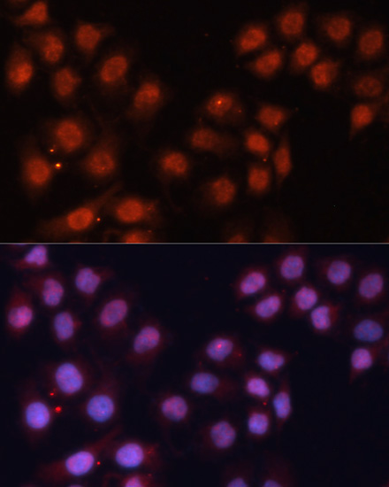 Immunofluorescence analysis of HeLa cells using CDK11B Polyclonal Antibody at dilution of 1:100. Blue: DAPI for nuclear staining.