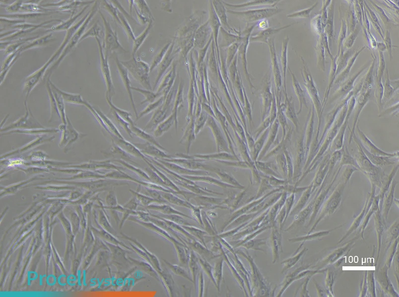 Human Uterine Fibroids Tissue-Derived Cell Complete Medium - 1