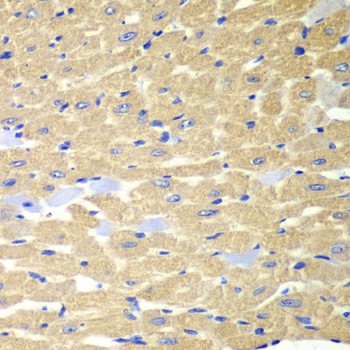Immunohistochemistry of paraffin-embedded Mouse heart using RPH3A Polyclonal Antibody at dilution of 1:100 (40x lens).