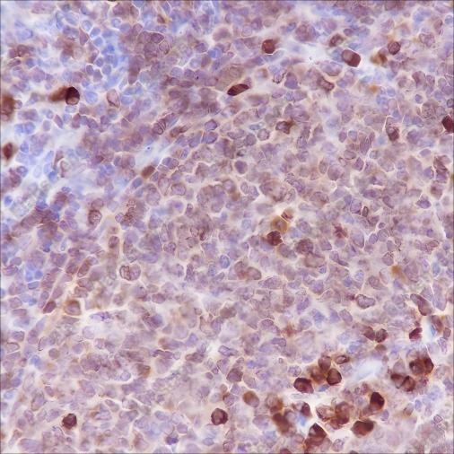 Recombinant CD79a Monoclonal Antibody - 3