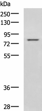 Western blot analysis of Rat liver tissue lysate  using DHX58 Polyclonal Antibody at dilution of 1:800