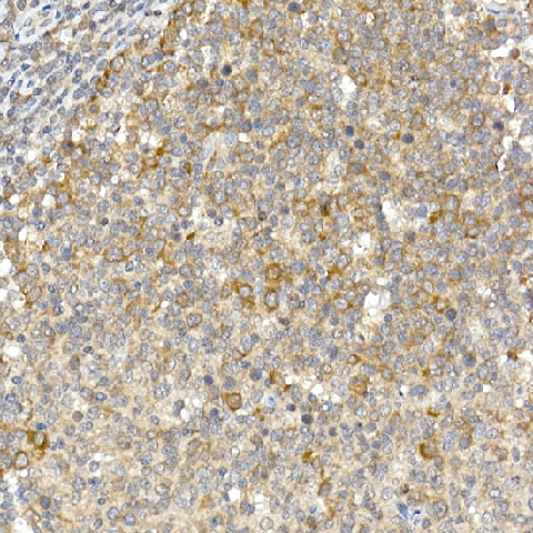 Immunohistochemistry of paraffin-embedded human tonsil using Caspase-12 Polyclonal Antibody at dilution of 1:100 (40x lens).Perform high pressure antigen retrieval with 10 mM citrate buffer pH 6.0 before commencing with IHC staining protocol.