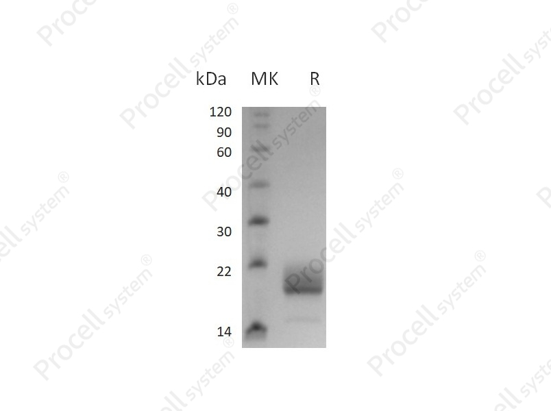 IL-4/BSF-1 (C-6His), Mouse, Recombinant