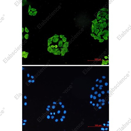 Recombinant SURF4 Monoclonal Antibody - 3