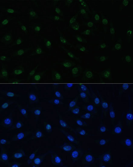 Immunofluorescence analysis of L929 cells using PELP1 Polyclonal Antibody at dilution of  1:100 (40x lens). Blue: DAPI for nuclear staining.