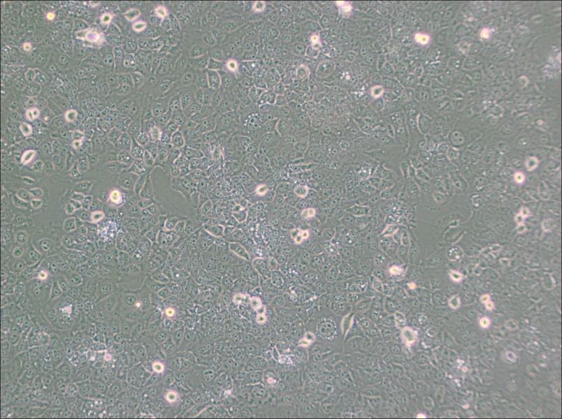 KYSE-30 Cell Complete Medium-searchlist-1