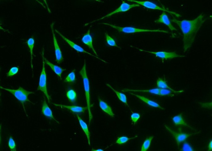 RhoA Monoclonal Antibody - small - 2