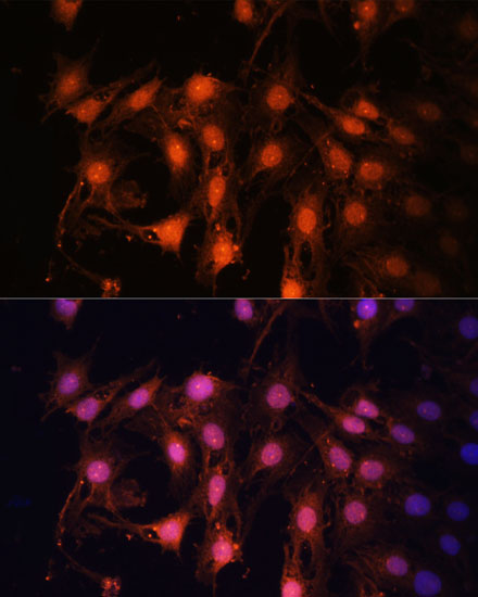 Immunofluorescence analysis of C6 cells using E2F1 Polyclonal Antibody at dilution of  1:100 (40x lens). Blue: DAPI for nuclear staining.