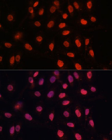 Immunofluorescence analysis of U-2 OS cells using Bcl-2 Polyclonal Antibody at dilution of  1:100 (40x lens). Blue: DAPI for nuclear staining.