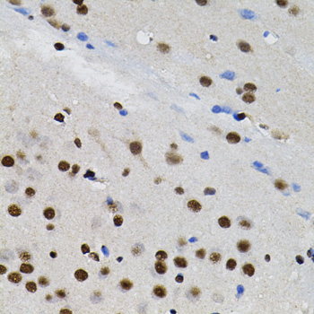 Immunohistochemistry of paraffin-embedded rat brain using GTF2I Polyclonal antibody (40x lens).Perform microwave antigen retrieval with 10 mM PBS buffer pH 7.2 before commencing with IHC staining protocol.