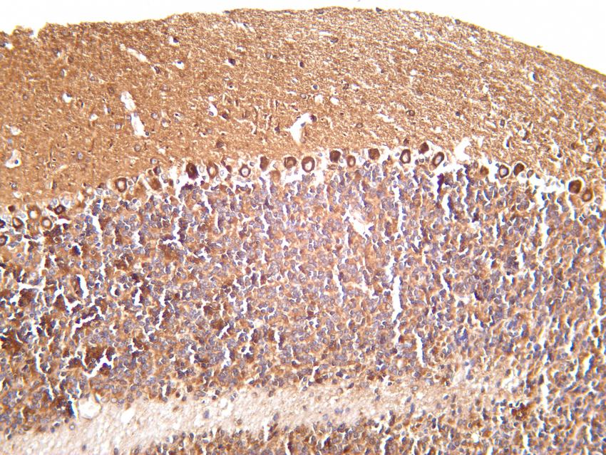 Recombinant DRP1 Monoclonal Antibody - small - 4