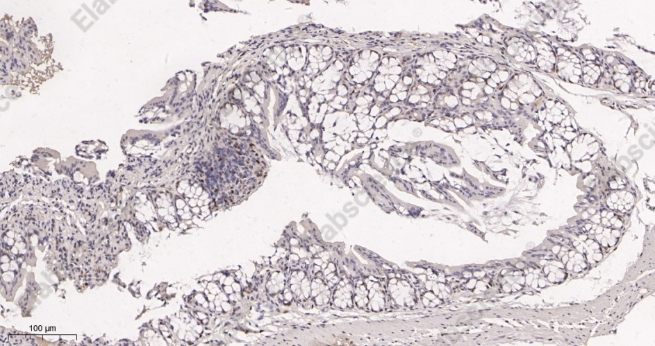 Recombinant Cyclin D1 Monoclonal Antibody - 3