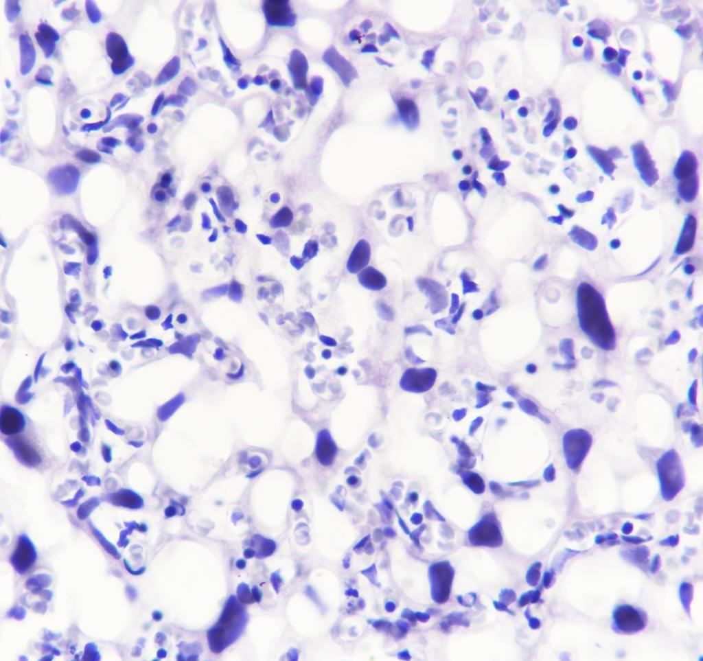 Recombinant Ryanodine Receptor Monoclonal Antibody - small - 5