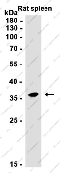 Recombinant UCH37 Monoclonal Antibody - 2